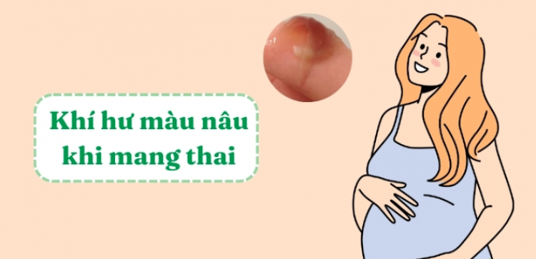 Mang thai ra khí hư màu nâu bình thường hay bất thường?