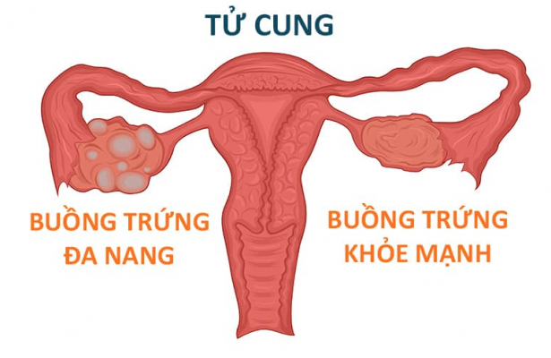 anh-buong-trung-da-nang
